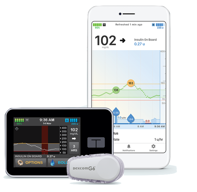 Control IQ with Dexcom