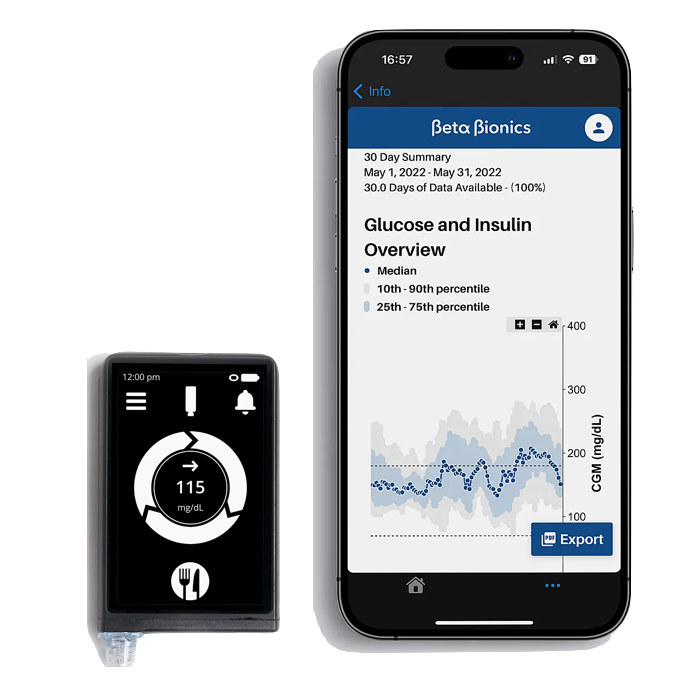 Beta Bionics iLet Pancreas