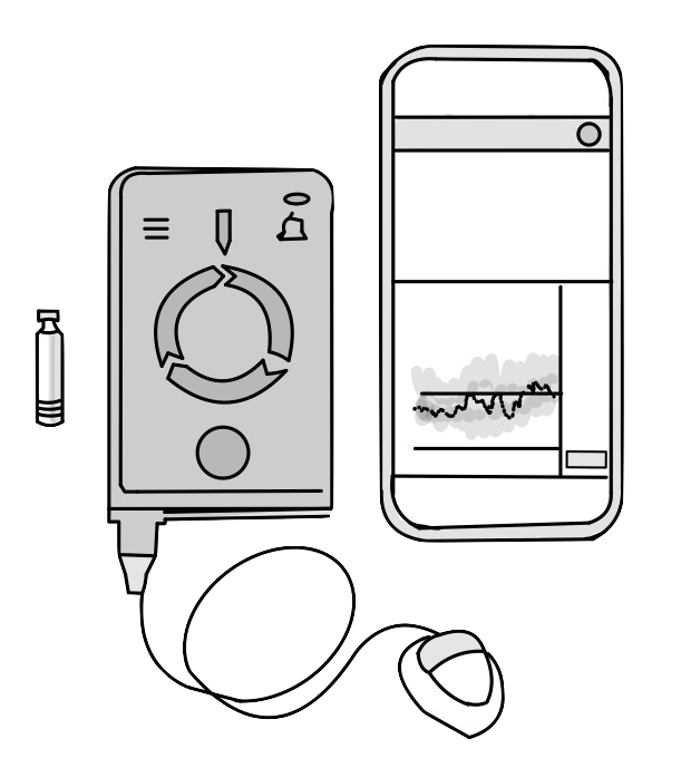 Beta Bionics iLet Pancreas