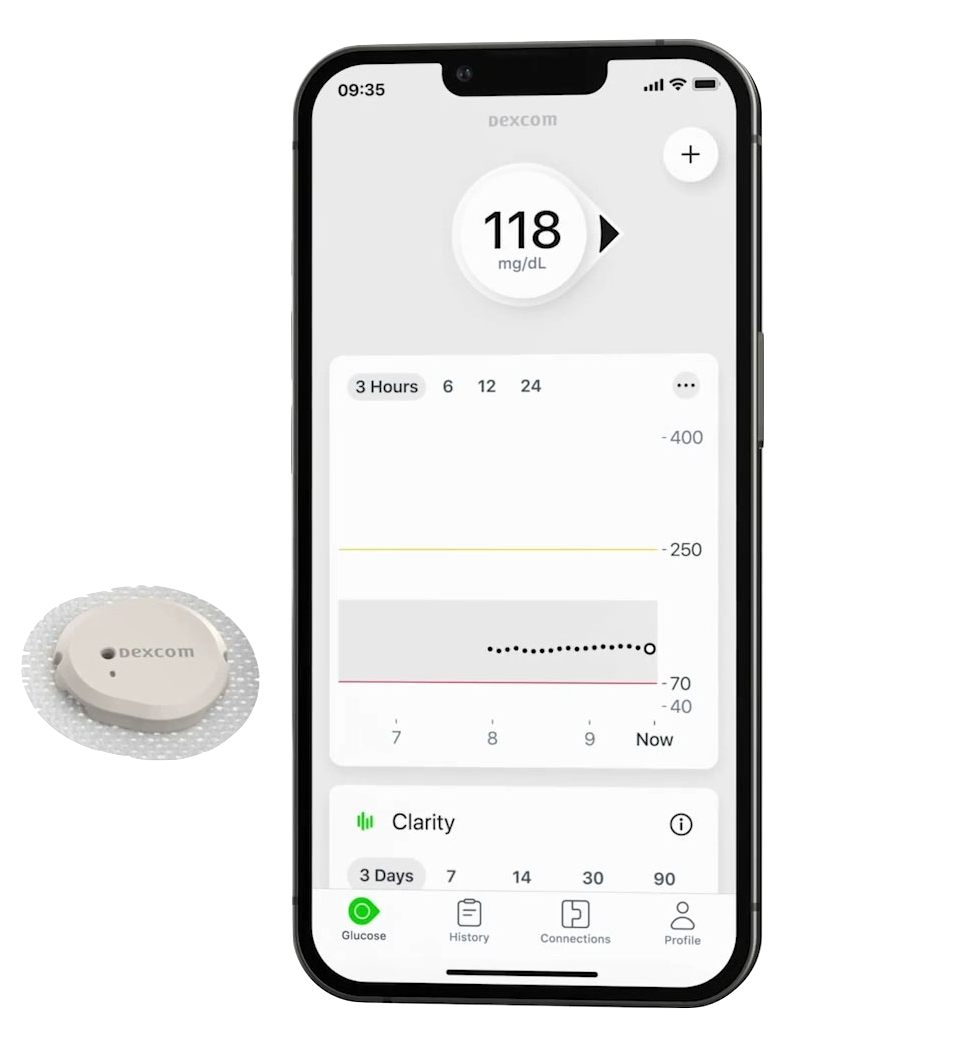 Dexcom G7